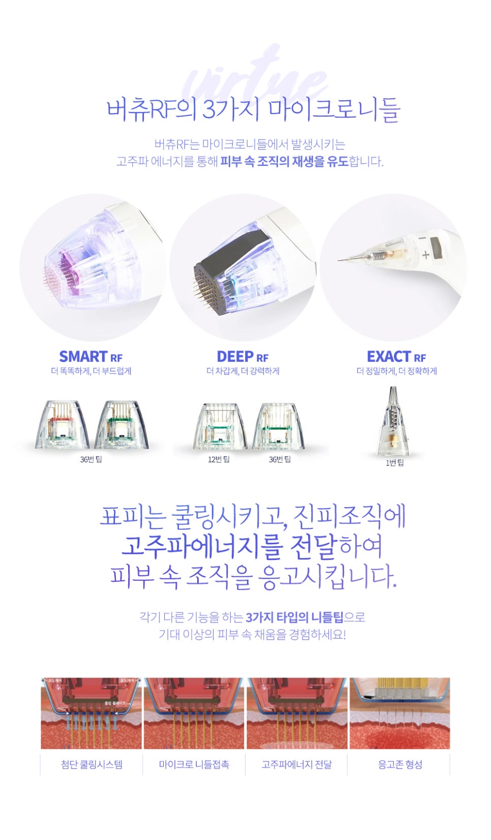 여드름 흉터치료 버츄RF로 고민 해결 관련 이미지 3