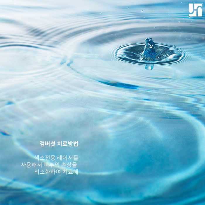 30대 검버섯 생길수 있어 주의 해야해 관련 이미지 4