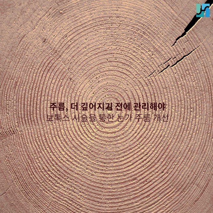 [방배역 피부과] 눈가 주름으로 고민하고 있다면 보톡스 한번 맞고 가세요! 관련 이미지 1