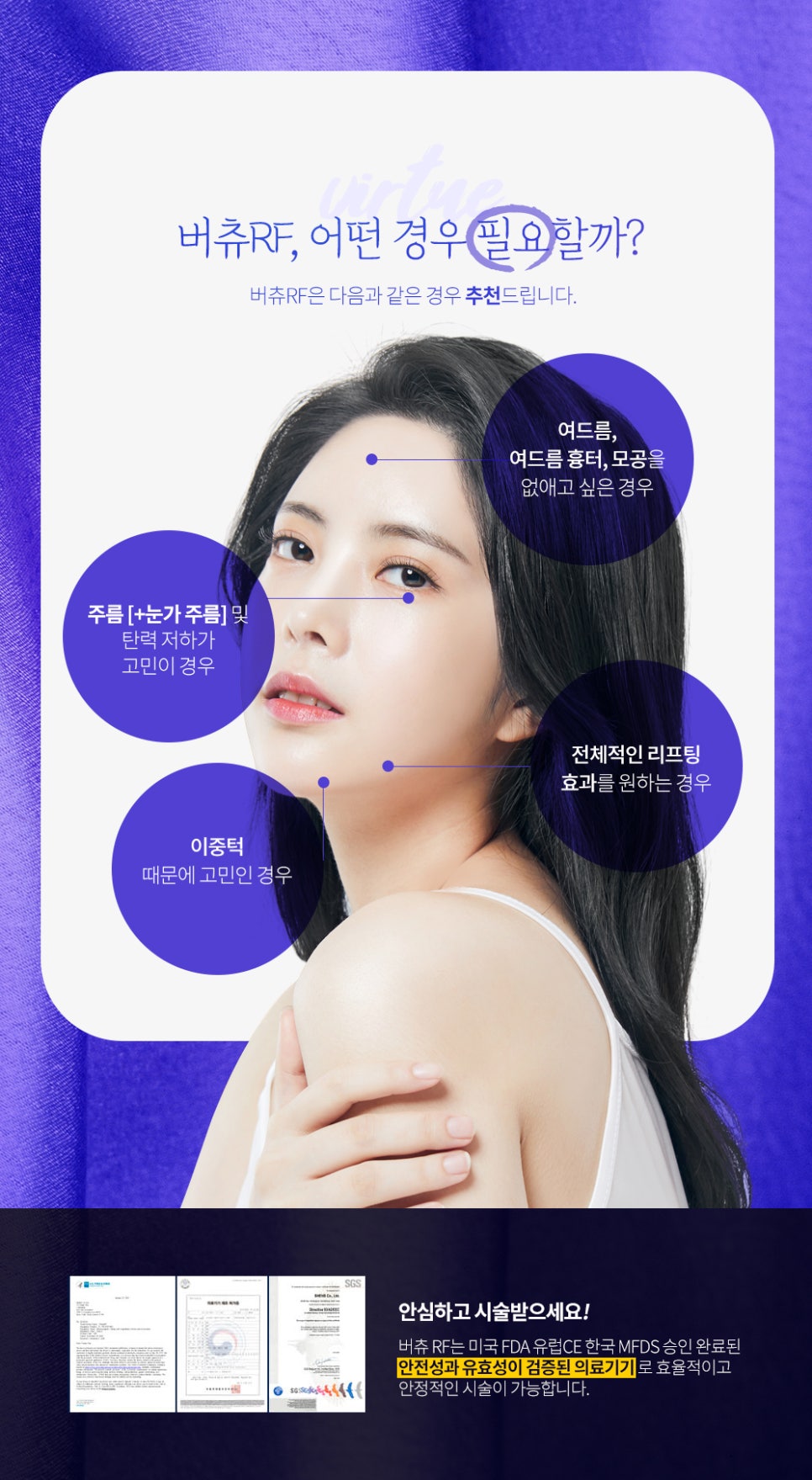 여드름 흉터치료 버츄RF로 고민 해결 관련 이미지 5