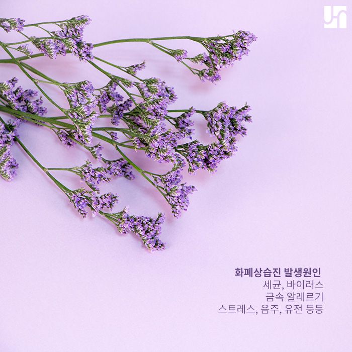 건조한 겨울에 발생하기 쉬운 화폐상습진 관련 이미지 2