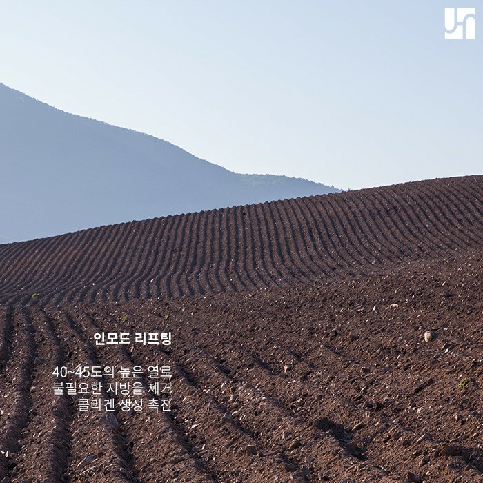 인모드 리프팅, 어떤 사람에게 효과가 좋은가요? 관련 이미지 2