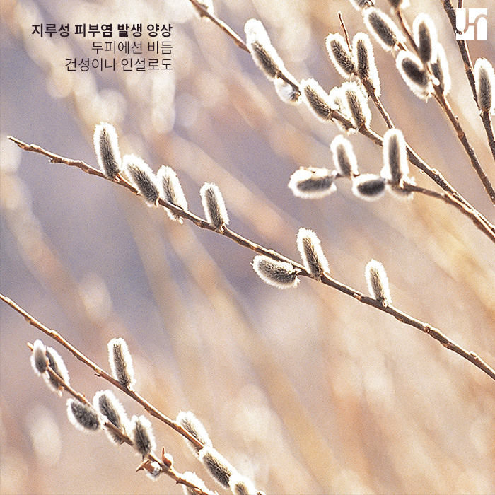 서초역 피부과, 지루성 피부염이 비듬의 원인인가요? 관련 이미지 3