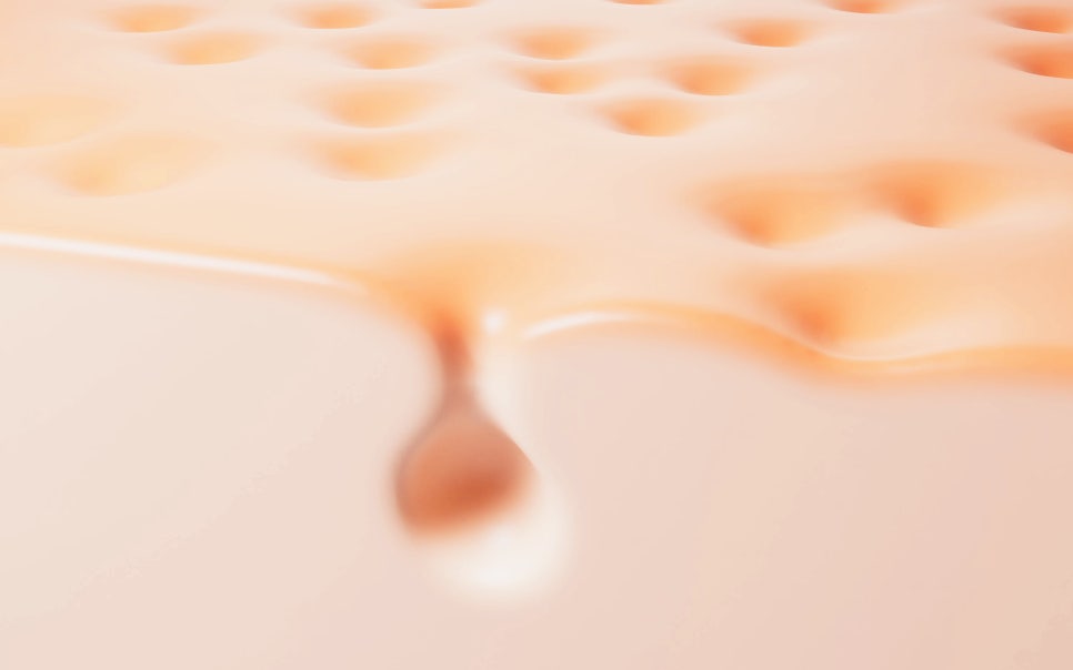 내방동 피부과 모낭염 원인과 증상 여드름과 헷갈리지 마세요 관련 이미지 3