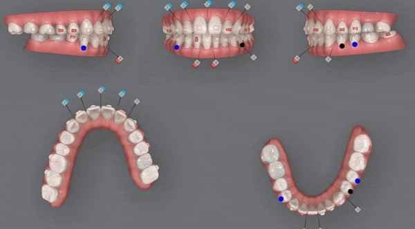 인비절라인 공식 스피커가 상주하고 치료하는 송파교정잘하는치과 유펜바른치과 (잠실성인교정 잠실재교정 잠실인비절라인 성인인비절라인교정 잠실나루역교정치과 문정동교정치과 삼전역교정치과) 관련 이미지 10
