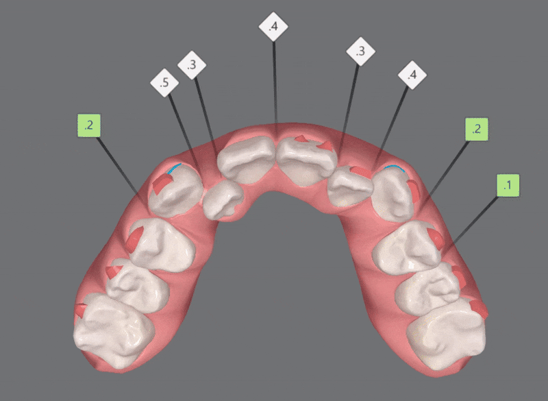 2024년 송파구 단일 치과의원급 중 유일!!! 인비절라인다이아몬드등급 달성한 유펜바른치과의 청소년인비절라인 후기 (청소년반대교합 어린이반대교합 잠실인비절라인잘하는치과) 관련 이미지 7