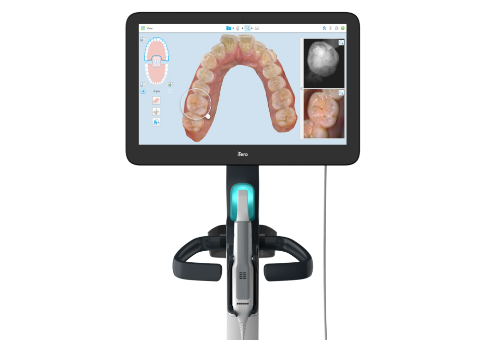 Invisalign Treatment, Korean Dental Hospitals, Dental Care Excellence 관련 이미지 3