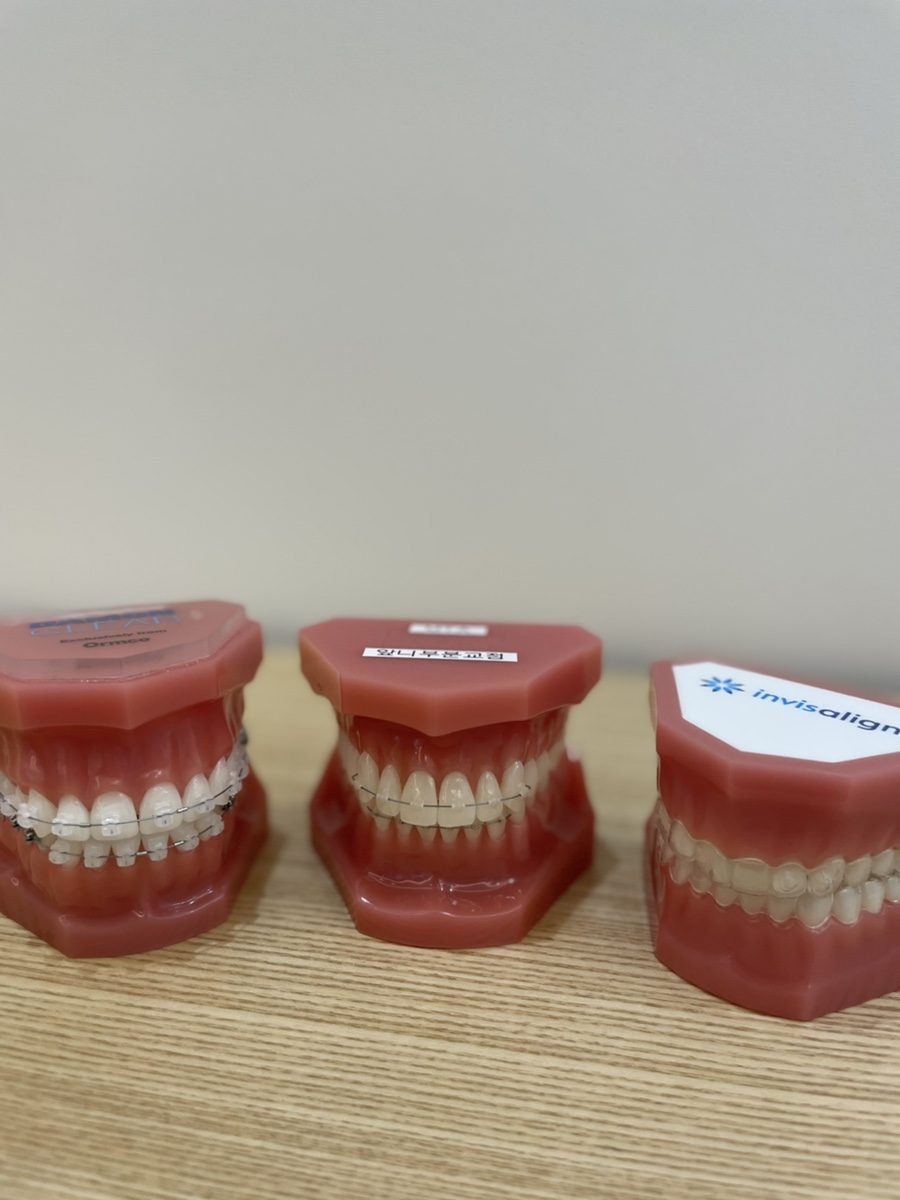 미니튜브를 이용한 MTA 교정 (앞니 부분 교정) 관련 이미지 4