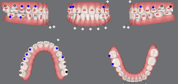 ★2022년 유펜바른치과 인비절라인플래티넘 등급 달성!★ 인비절라인 시작하시려는 분들 필독! 관련 이미지 7