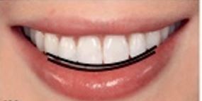 유학생치아교정 유학생교정치과 잠실교정치과 잠실데이몬교정 데이몬클리어교정 Wide Smile (송파교정치과 잠실새내교정치과 강동교정치과 헬리오시티교정치과 예쁜미소 Smile Arc) 관련 이미지 16