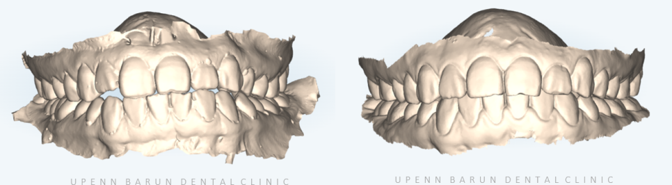 안면비대칭, 잠실수술교정, 잠실양악수술도 유펜바른치과입니다. 관련 이미지 3