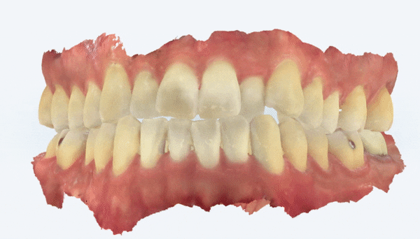 2023 Invisalign Day에서 상 받았어요!! (시상식 후기 ㅣ 인비절라인데이 ㅣ 포시즌스호텔  ) 관련 이미지 13