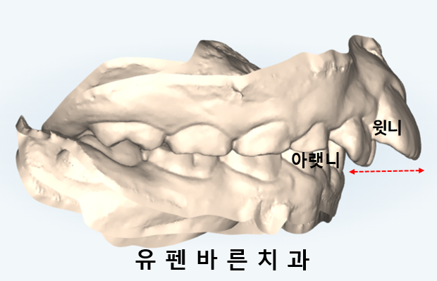 우리아이, 무턱교정 해야할까요? 관련 이미지 3