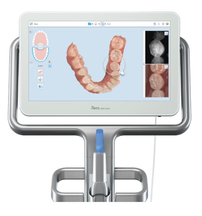 인비절라인 제작과정, 제작까지 소요시간, 어떻게 만들어지는지 궁금하다면?  (치아교정 l 투명교정 l 인비절라인) 관련 이미지 3