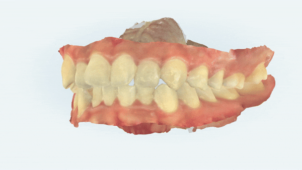 유학생치아교정 유학생교정치과 잠실교정치과 잠실데이몬교정 데이몬클리어교정 Wide Smile (송파교정치과 잠실새내교정치과 강동교정치과 헬리오시티교정치과 예쁜미소 Smile Arc) 관련 이미지 3