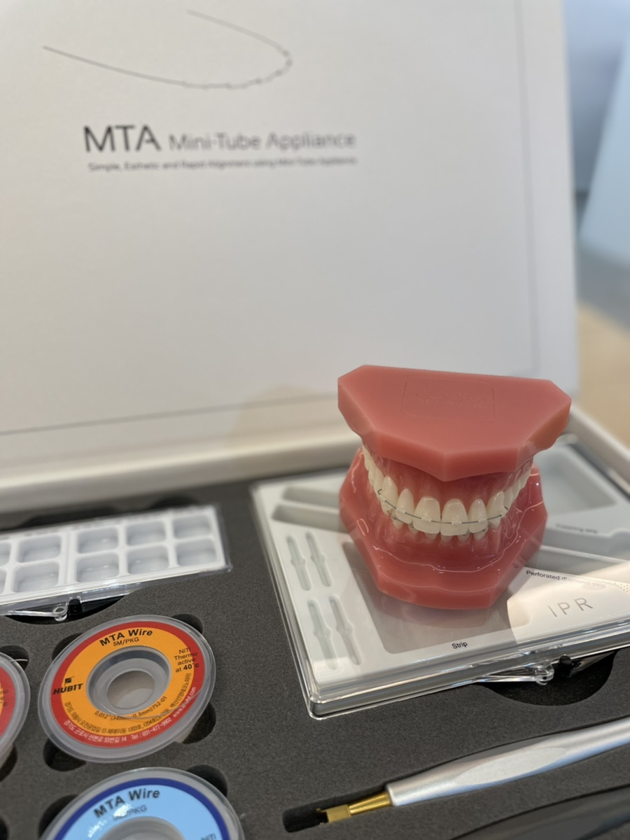 미니튜브를 이용한 MTA 교정 (앞니 부분 교정) 관련 이미지 3