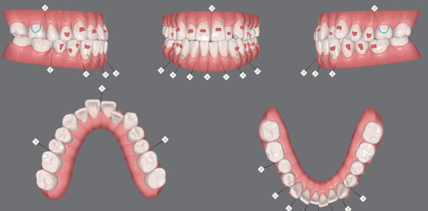 2023 Invisalign Day에서 상 받았어요!! (시상식 후기 ㅣ 인비절라인데이 ㅣ 포시즌스호텔  ) 관련 이미지 12