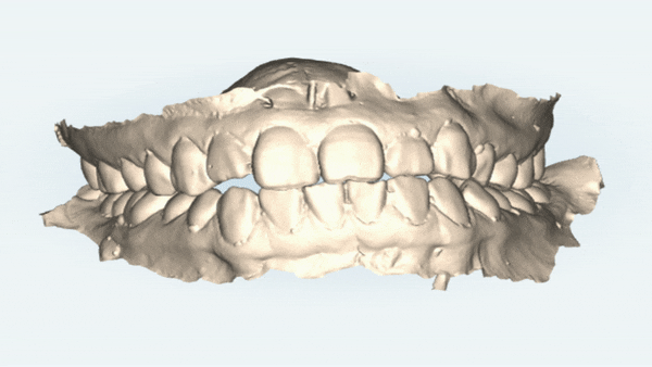 안면비대칭, 잠실수술교정, 잠실양악수술도 유펜바른치과입니다. 관련 이미지 2