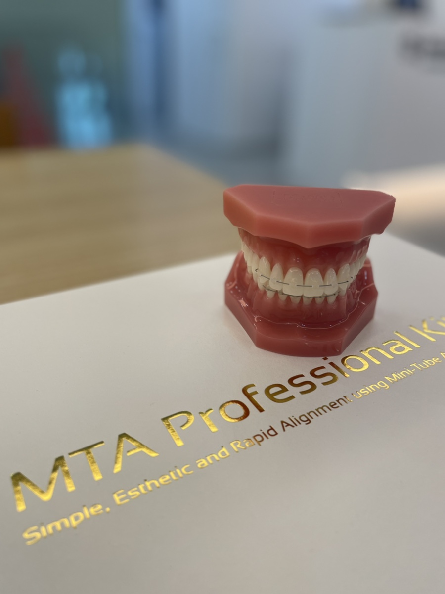 미니튜브를 이용한 MTA 교정 (앞니 부분 교정) 관련 이미지 2