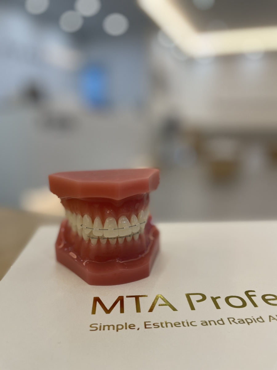 미니튜브를 이용한 MTA 교정 (앞니 부분 교정) 관련 이미지 1