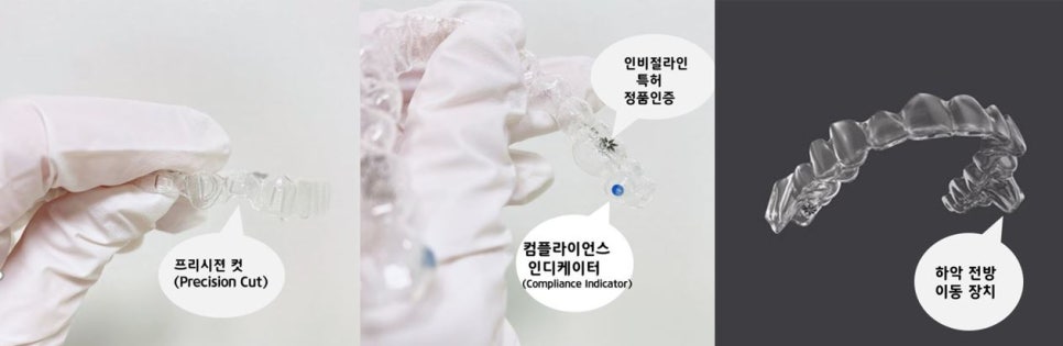 전세계 1400만명이 선택한 교정장치, 인비절라인 관련 이미지 6