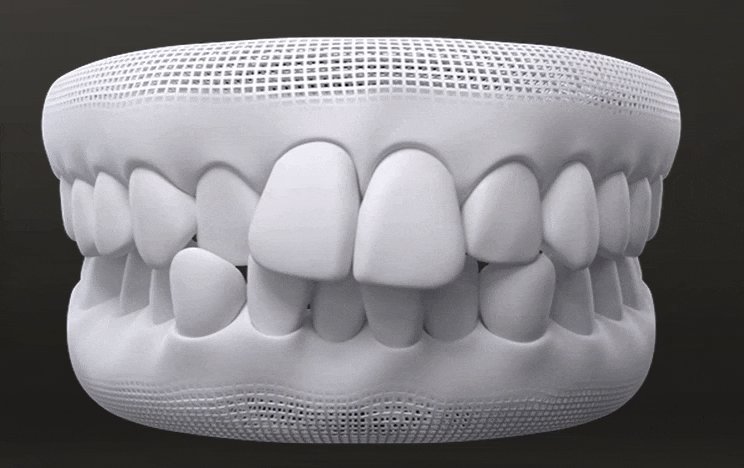 인비절라인 제작과정, 제작까지 소요시간, 어떻게 만들어지는지 궁금하다면?  (치아교정 l 투명교정 l 인비절라인) 관련 이미지 1