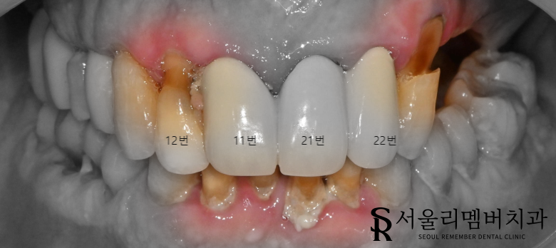 신풍역 치과 개인에게 딱 맞는 맞춤 계획으로-! 관련 이미지 1