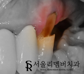 신풍역 치과 개인에게 딱 맞는 맞춤 계획으로-! 관련 이미지 3