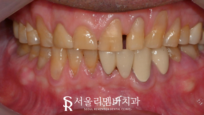 서울대입구역치과 에서 알려주는 관련 이미지 3