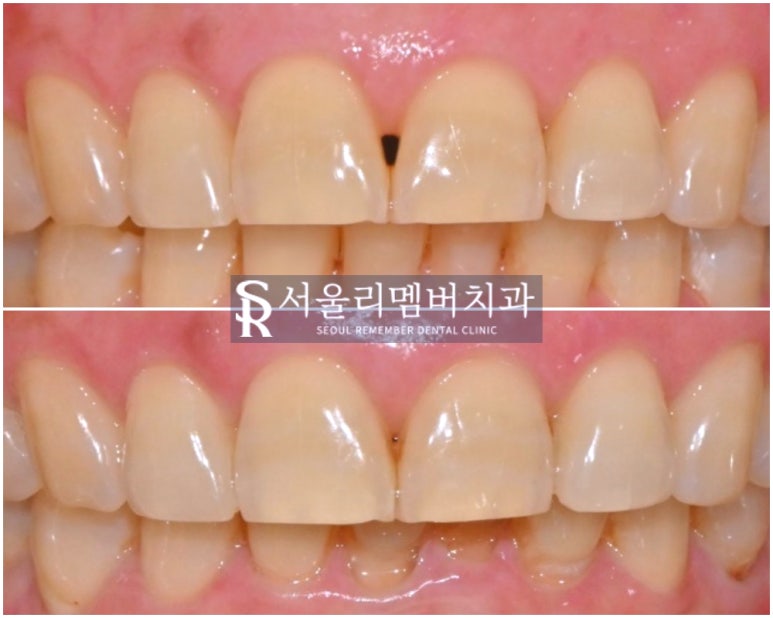 상도동 치과 심미 치료 잘하는 곳 찾는다면 관련 이미지 1