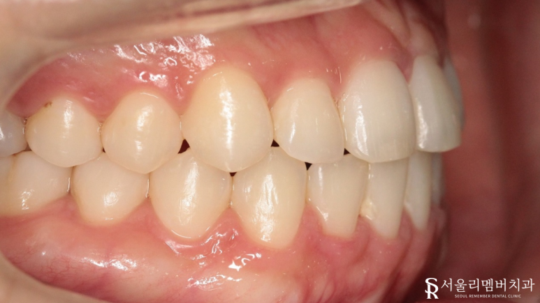 봉천동치과 관련 이미지 6