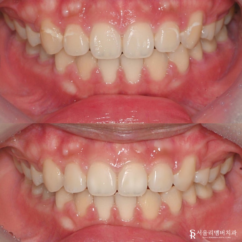 서울대입구역 치과 관련 이미지 3