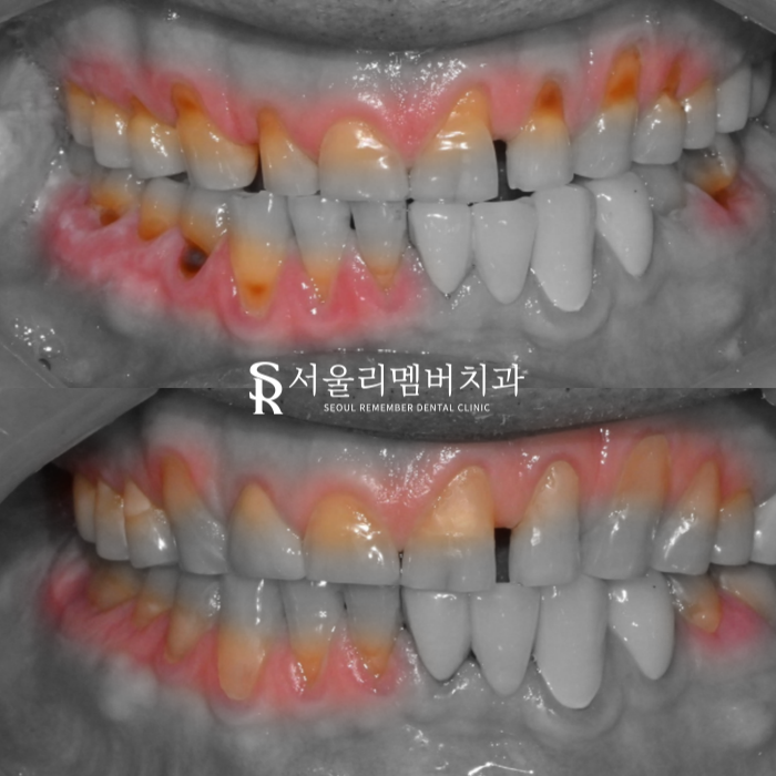 서울대입구역치과 에서 알려주는 관련 이미지 4