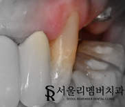 신풍역 치과 개인에게 딱 맞는 맞춤 계획으로-! 관련 이미지 4