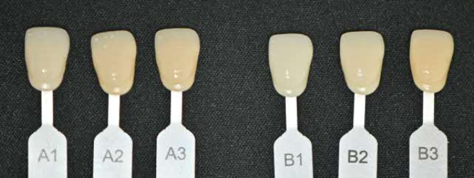 "앞니가 변색돼서 보기 싫어요" 보라매 치과 에서 미백치료 관련 이미지 2