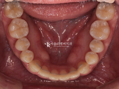 봉천동치과 관련 이미지 8