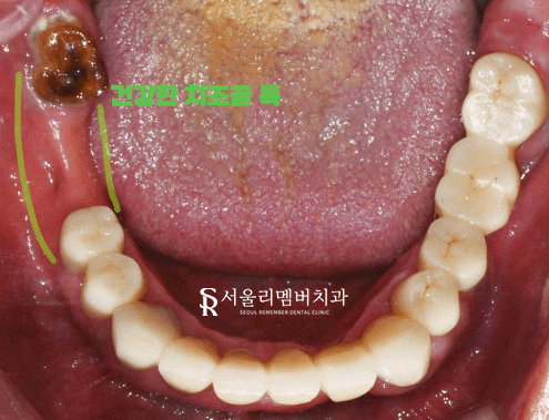 야간 진료 가능한 서울대입구역 치과 에서 퇴근 후에도 임플란트 하실 수 있습니다. 관련 이미지 2