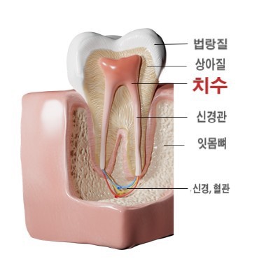 봉천역 치과 에서 레진 당일 치료로 치경부마모증(CA)를 개선해드렸습니다. 관련 이미지 2