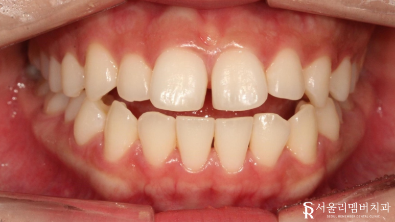 봉천동치과 관련 이미지 1