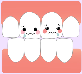 신림 치과 깨지고 길이 안 맞는 앞니 부러진 부분만 레진으로 간단하게 당일 치료 관련 이미지 4