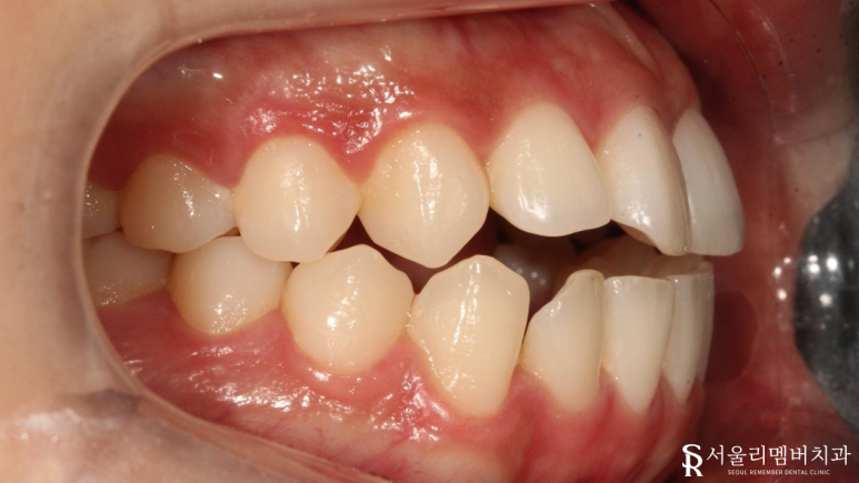 봉천동치과 관련 이미지 2