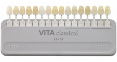 서울대입구역 치과 연말 모임 행사 준비의 시작은 원데이 치아미백 관련 이미지 3