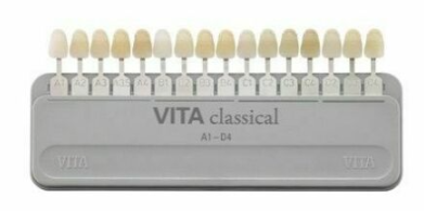 My Teeth Have Turned Yellow: The Transformation Process Through Aesthetic Professional Whitening at a Nakseongdae Station Dental Clinic image 2