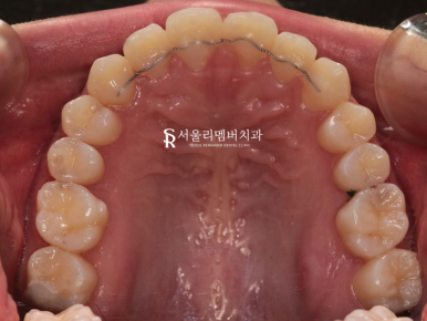 봉천동치과 관련 이미지 7