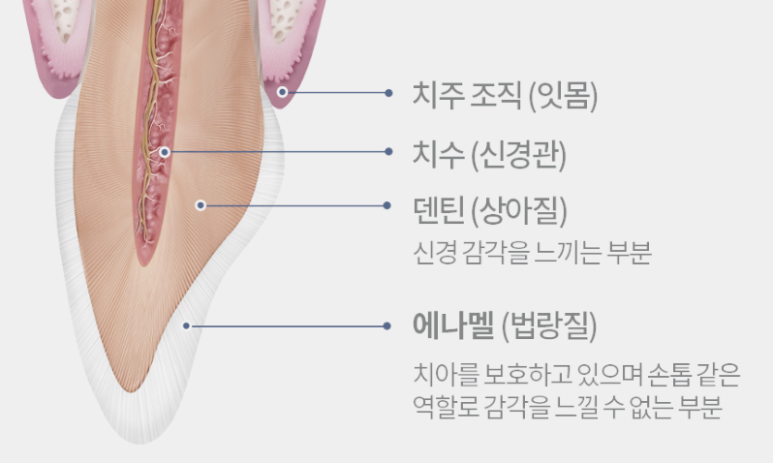 신대방 치과 "처음에는 작은 충치, 나중에는 치아 발치?" 앞니 임플란트 및 신경치료 후기 관련 이미지 3