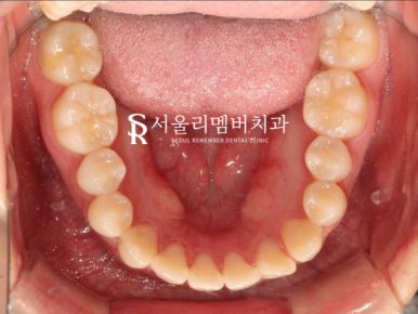 봉천동치과 관련 이미지 4