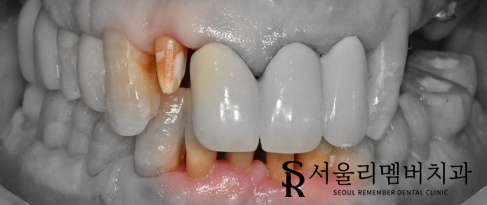 신풍역 치과 개인에게 딱 맞는 맞춤 계획으로-! 관련 이미지 2