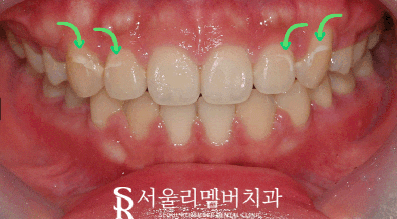 서울대입구역 치과 관련 이미지 2