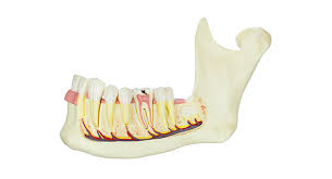 영등포 치과 대학병원 가지 않고 매복니 뽑을 수 있을까요? 관련 이미지 1