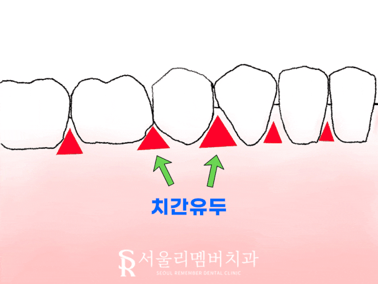신림 치과 에서 전문가 치아 미백으로 안전하게! 관련 이미지 2